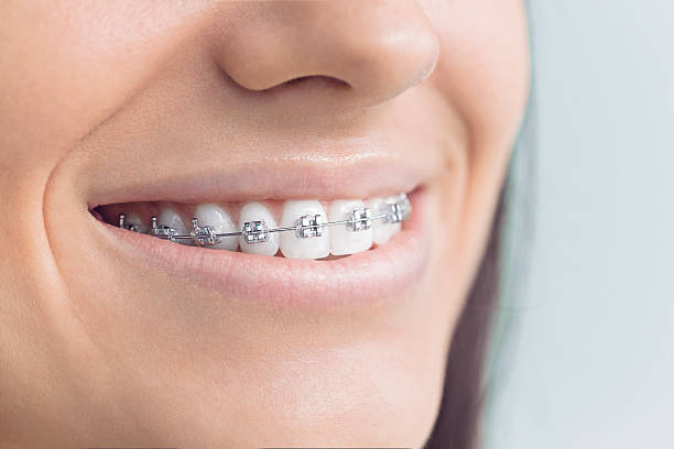 Best TMJ/TMD Treatment  in Estero, FL